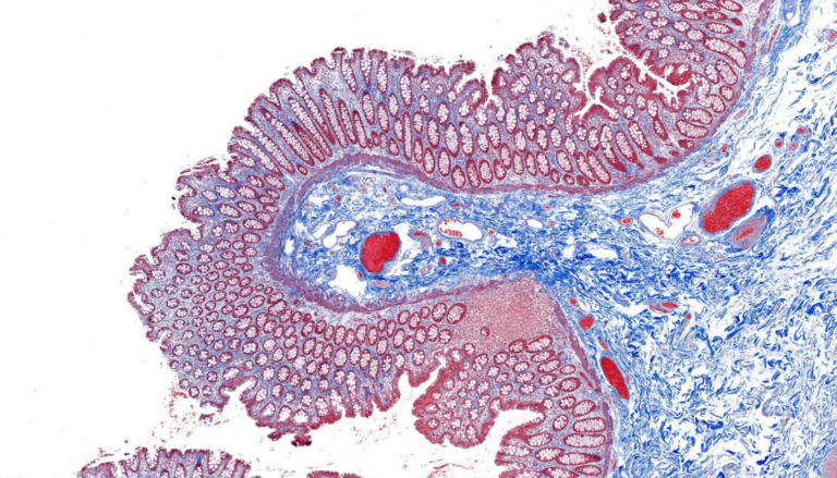 Histology Image