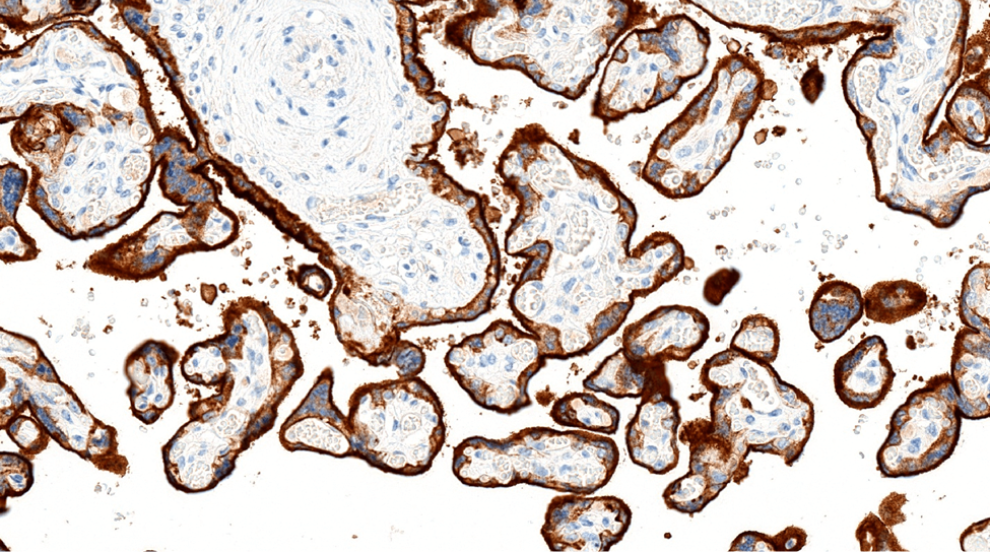 Placenta stained via Immunohistochemistry (IHC) for PD-L1