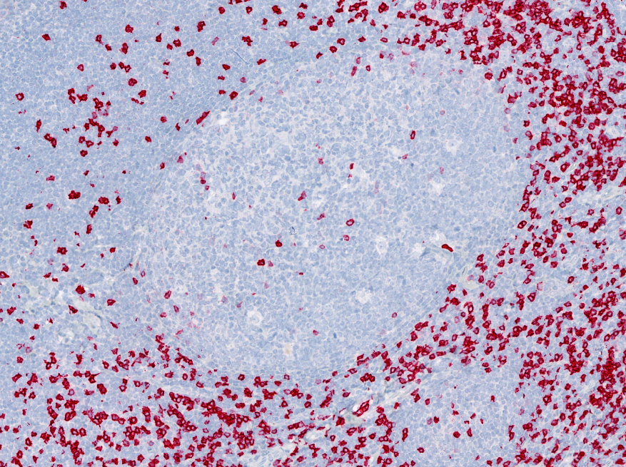 IHC, Tonsil