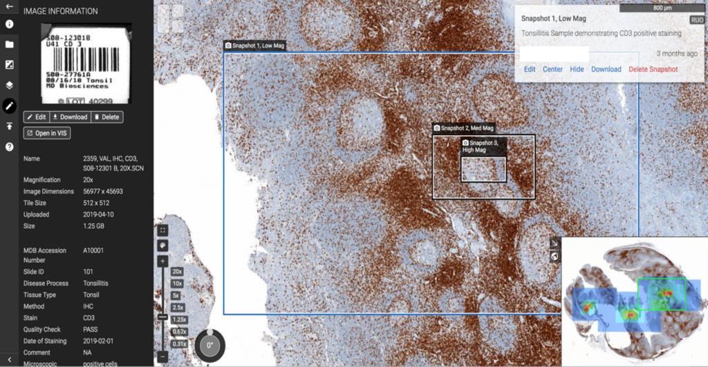 Digital pathology