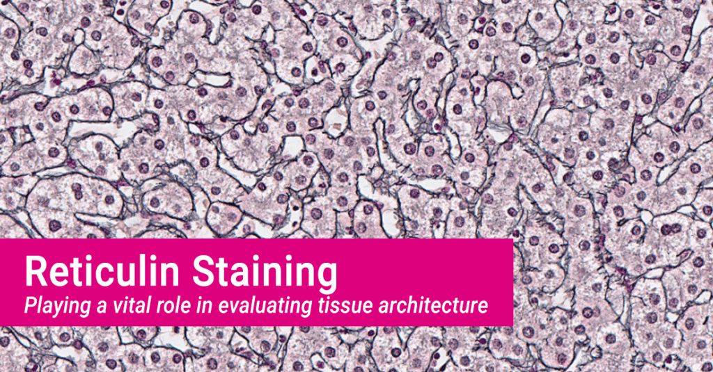 Reticulin Staining at MLM Medlcal Labs Histology Dept