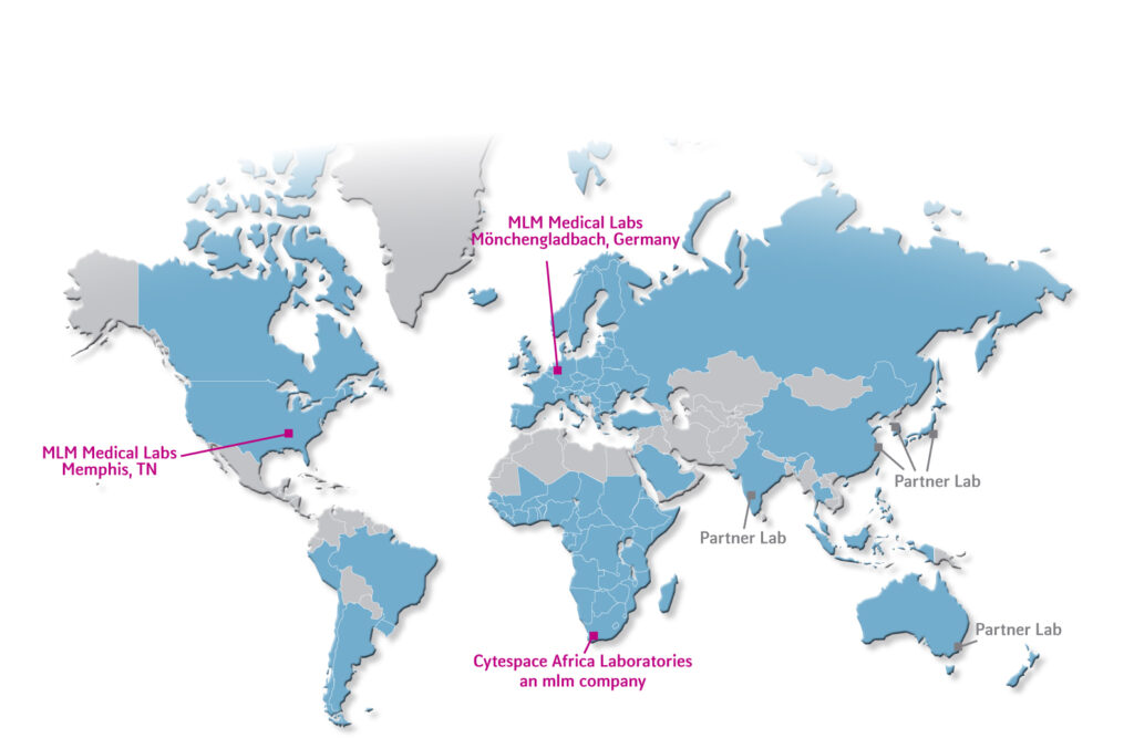 MLM Global Central Lab Map